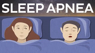 Sleep apnea definition symptoms diagnosis and treatment [upl. by Anuala]