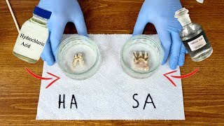 Leaving TEETH in HYDROCHLORIC and SULFURIC ACIDS Experiment [upl. by Homerus]