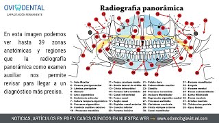 👁‍🗨 RADIOGRAFÍA PANORÁMICA Indispensable para estudiar el Componente ÓseoDental Maxilofacial [upl. by Hakvir]