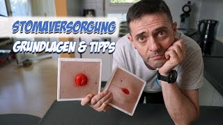 Stomaversorgung Grundlagen und Tipps  Pflege  Pflege Kanal [upl. by Hughie]