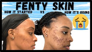 FENTY SKIN REVIEW FINAL THOUGHTS Rihanna Made Me Cry  Kia Rene [upl. by Verene]