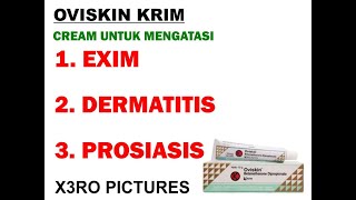 Oviskin Cream Mengatasi Dermatitis Dan Eksim [upl. by Garrek781]