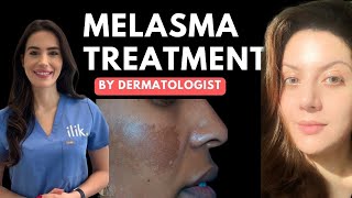 Dermatologist approved routine for Melasma  How to use hydroquinone [upl. by Thorfinn477]