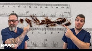 INSANE Amount Of Hair Removed From My Ear Canal  EP992 [upl. by Leupold]