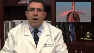 EGD explained by Dr Gilbert Simoni [upl. by Brooks]