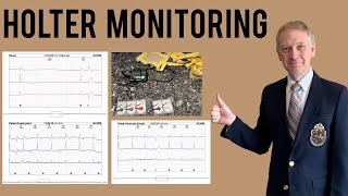 Holter Monitor  Everything you need to know [upl. by Dena662]