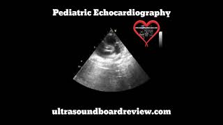 Total Anomalous Pulmonary Venous Return [upl. by Aya]