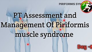 Day 8  Piriformis syndrome Physiotherapy Assessment and Management  Piriformis syndrome [upl. by Starlene]