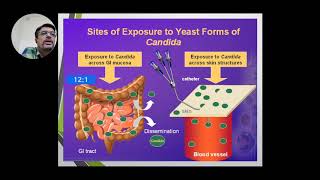 Opportunistic Mycoses I  Candidiasis [upl. by Nina]