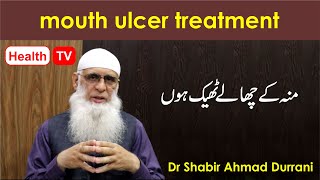 mouth ulcer causes and treatment [upl. by Ion]