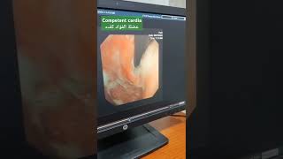 competent cardiaعضلة الفؤاد كفء [upl. by Nylhsoj]