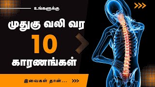 Back Pain  10 Common Causes  24 Tamil Health [upl. by Ytisahcal853]