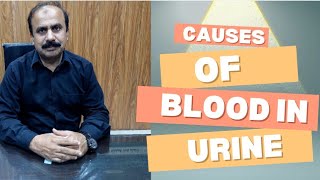 what causes blood in urineDr Abdul Majeed [upl. by Sjoberg]