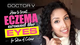 Doctor V  How To Treat Eczema around the Eyes for Skin of Colour  Black or Brown Skin [upl. by Derag]