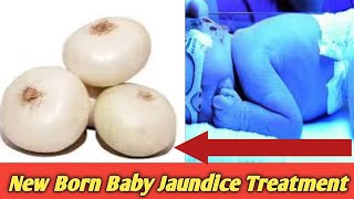 White Onion for Jaundice in Newborns👶🏻👶🏻  Natural Healing Tips for New Moms🧄🧄 [upl. by Eahsat]