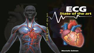 E3 Ischemic heart disease P2 [upl. by Stephannie]