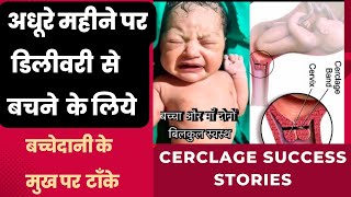 अधूरे महीने पर डिलीवरी से बचने के लिये गर्भाशय के मुख पर टाँके Dos amp Donts after Cerclage stitch [upl. by Borek]