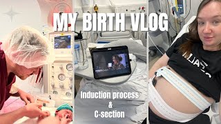 MY BIRTH VLOG amp STORY  Induction amp Csection [upl. by Anale303]