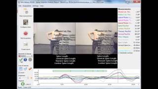 Spinal Analysis 3D segmental protocol in Simi Aktisys [upl. by Wolpert]