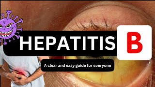 Hepatitis B  Hepatitis B Symptoms  Hepatitis B Tests  Hepatitis B By Dr Shams [upl. by Tilla]