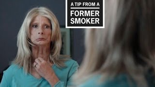 CDC Tips From Former Smokers  Terrie H’s Tip Ad [upl. by Issim]