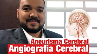 Aneurisma Angiografia Cerebral Precisa fazer para confirmar [upl. by Hort]