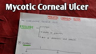 MYCOTIC CORNEAL ULCER  A K KHURANA  OPHTHAL [upl. by Ahsiad]