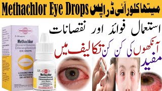 Methachlor Eye Drops PriceUsesBenefitsSide Effects Redness of Eye Swelling in eye [upl. by Adle]