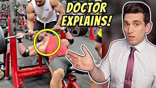 Doctor Reacts to Larry Wheels RUPTURED PEC Video of Ryan Crowley and Explains Injury [upl. by Wylen178]