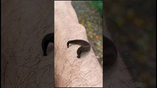 Dont Let Leeches Suck Your Blood‖Leech on skin ‖animal shortsfeed viral short [upl. by Imoan771]