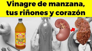 Lo que el VINAGRE DE MANZANA le puede hacer a tus riñones esmalte dental y a tu corazón [upl. by Atiuqam]