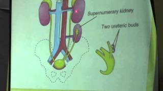 12 DrDoaa 2042015 metanephros  conginetal anomalies of kidney  cloaca  urinary bladder [upl. by Yrad208]