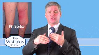 Phlebitis  What is phlebitis and how should phlebitis be treated [upl. by Nahtnahoj]