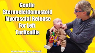 Gentle Sternocleidomastoid Myofascial Release LeftSided Torticollis Treatment in Babies 042L [upl. by Ecniv]