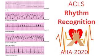 ACLS Rythem Recognitions 2023 Easy guide [upl. by Osman]