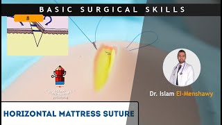 Horizontal Mattress Suture [upl. by Rosamond]