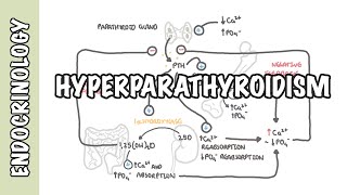 Hyperparathyroidism and the different types causes pathophysiology treatment [upl. by Wivestad597]