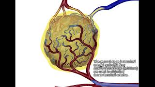 Transarterial Chemoembolization for HCC  Supplementary video ID 433409 [upl. by Azarria]