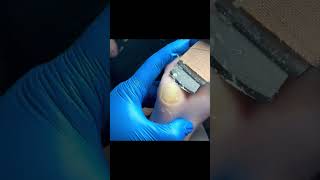 Charming Pedicure Video  Remove Dead Skin [upl. by Ahsenyl]