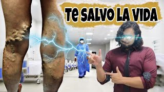 Ejercicios que NO PUEDES HACER si tienes VÁRICES PARTE 2 [upl. by Lewap]