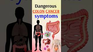 Cancer Symptoms You Should NEVER Ignore [upl. by Dam782]