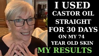 I USED CASTOR OIL FOR 30 DAYS ON MY 74YEAROLD SKIN  MY RESULTS [upl. by Rebmeced]