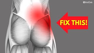 How to Fix OneSided Lower Back and Hip Pain [upl. by Beare793]