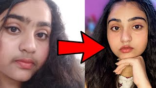 Teenage Facial Hair Removal with total Natural Ingredients How I removed my Facial Hairs Naturally [upl. by Raamal]