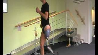 Above knee amputee running on prosthetic leg [upl. by Llig475]