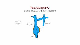 Persistent Left Superior Vena Cava Left SVC  Embryology and Clinical Anatomy [upl. by Shenan]