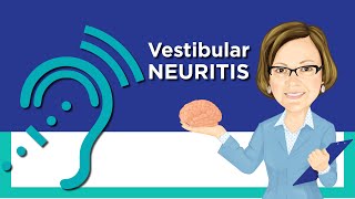 Vestibular Neuritis [upl. by Alleber]