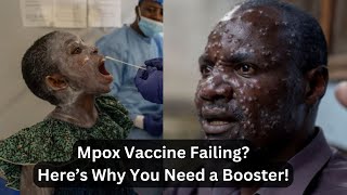 Mpox Vaccine Protection Reduces Why You may Require a Booster Soon [upl. by Lynnell]