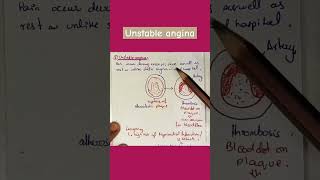 Unstable angina stable angina variant angina angina medical [upl. by Sirotek]