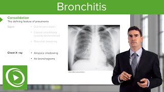 Pneumonia Introduction amp Types – Respiratory Medicine  Lecturio [upl. by Havens]